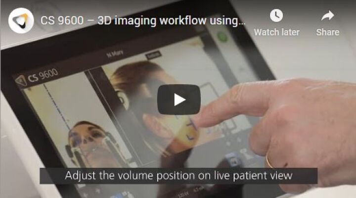 Carestream Dental CS 9600 Extraoral Imaging